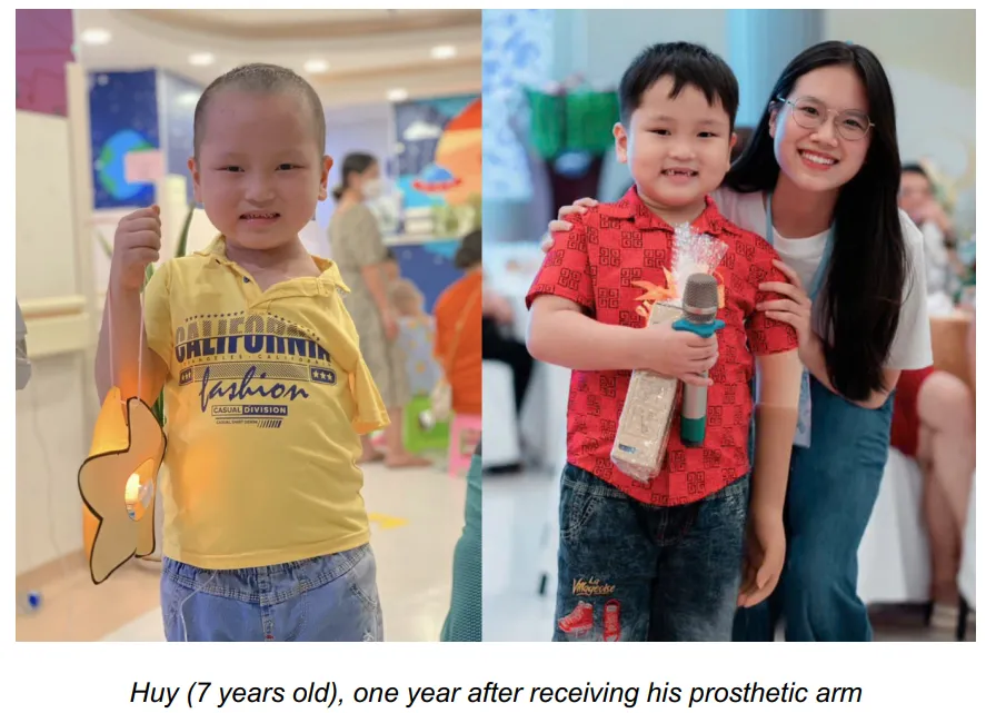 Treatment equipment support